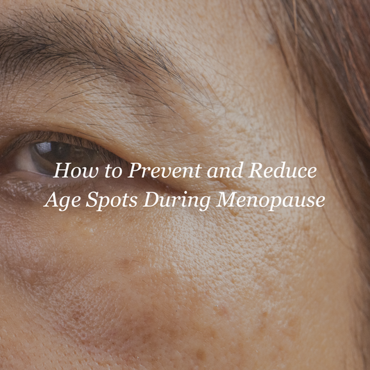 How to Prevent and Reduce Age Spots During Menopause